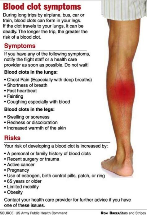 What Cause Blood Clots In Legs